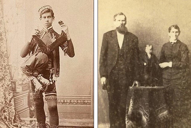 freak shows in the 19th century essay In the 19th century, “freak shows” and circuses were extremely popular in showcasing this type of recreational fear freak show, which is described essay. freak shows in the 19th century essay In the 19th century, “freak shows” and circuses were extremely popular in showcasing this type of recreational fear freak show, which is described essay.